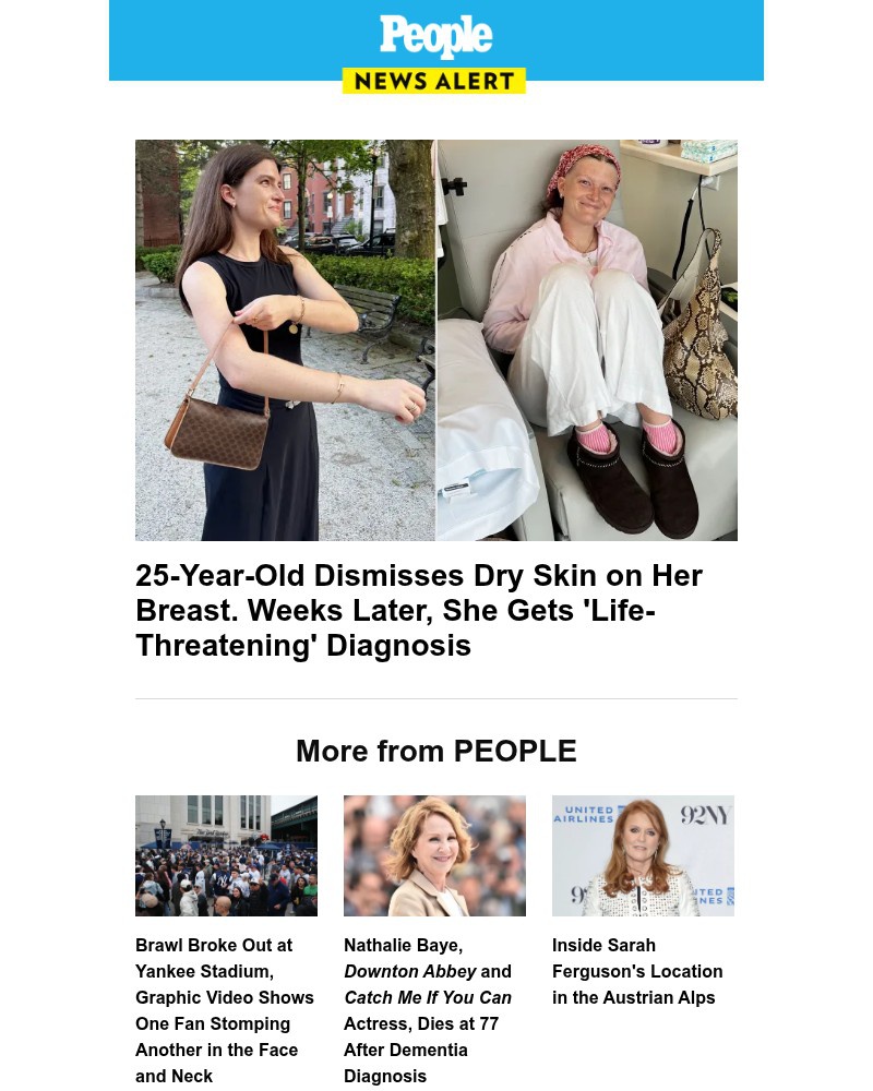 Screenshot of email with subject /media/emails/25-year-old-dismisses-dry-skin-on-her-breast-weeks-later-she-gets-life-threatenin_ZXVrs3B.jpg