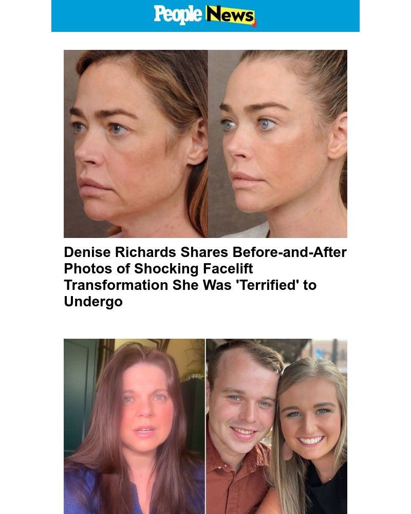 Screenshot of email with subject /media/emails/denise-richards-shares-before-and-after-photos-of-shocking-facelift-transformatio_78RdwZf.jpg