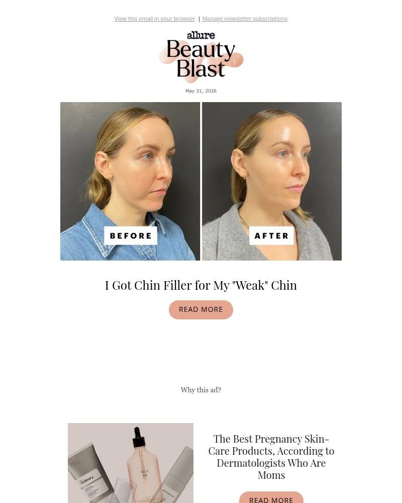 Screenshot of email sent to a allure Newsletter subscriber