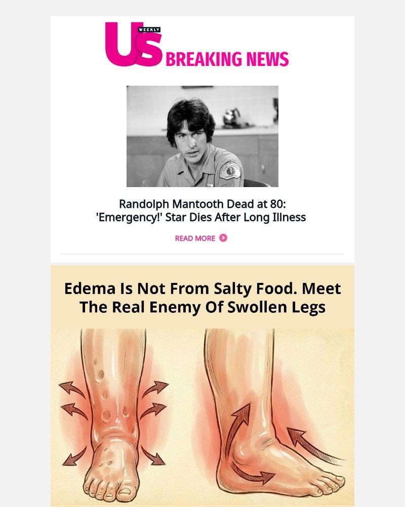 Screenshot of email with subject /media/emails/randolph-mantooth-dead-at-80-emergency-star-dies-after-long-illness-e1a1c3-croppe_FjNT8fv.jpg