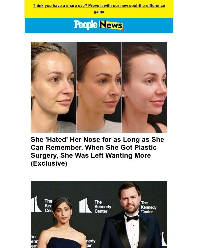 Screenshot of email with subject /media/emails/she-hated-her-nose-for-as-long-as-she-can-remember-when-she-got-plastic-surgery-s_MrDfnQC.jpg
