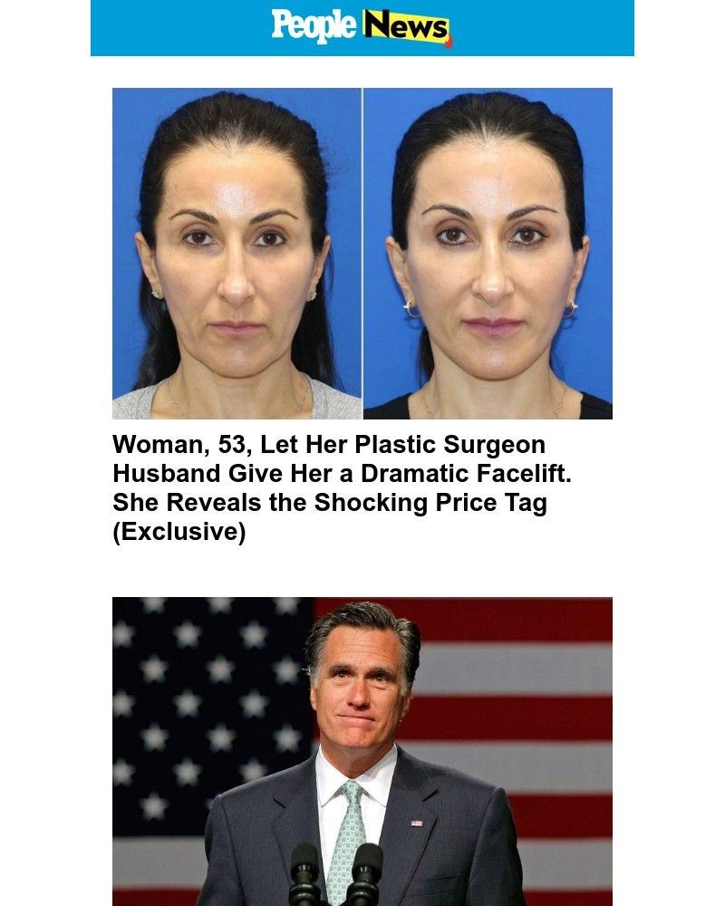Screenshot of email with subject /media/emails/woman-53-let-her-plastic-surgeon-husband-give-her-a-dramatic-facelift-she-reveals_RBaqZth.jpg