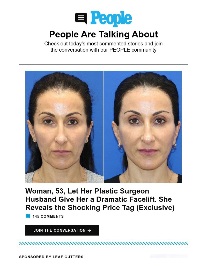 Screenshot of email with subject /media/emails/woman-gets-dramatic-facelift-from-her-surgeon-husband-kevin-federline-claims-brit_9B3f58Q.jpg