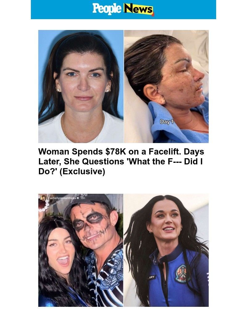 Screenshot of email with subject /media/emails/woman-spends-78k-on-a-facelift-days-later-she-questions-what-the-f-did-i-do-exclu_Vow14sX.jpg